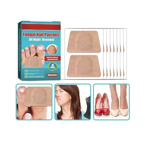 Nalacal Anti Fungal Nail Treatment Patches Toe Fungus Onychomycosis