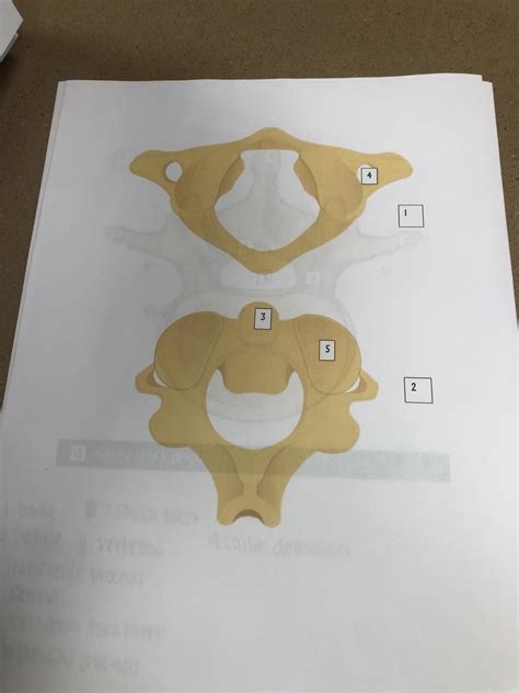 vertebral #2 Diagram | Quizlet