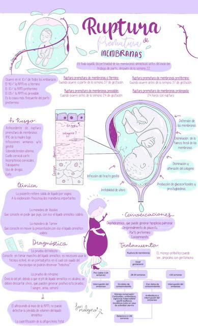 Ruptura Prematura De Membranas Udocz