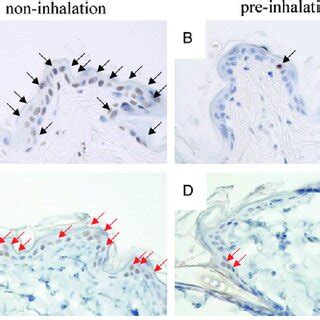 8 OHdG Immunohistochemistry Staining Of Skin Sections 24 H After 20 Gy