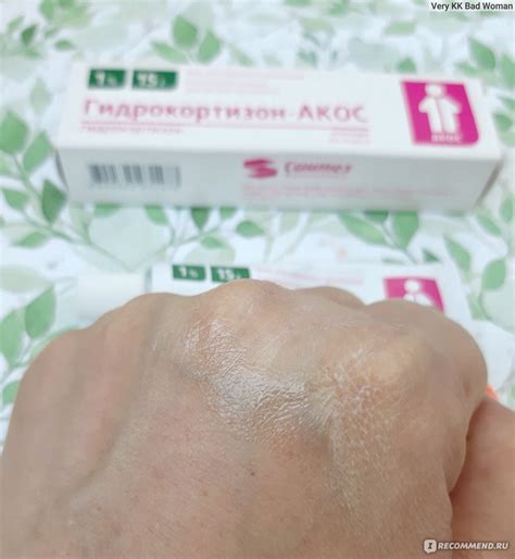Мазь ОАО "Синтез" Гидрокортизон-Акос - «Мой 15-летний опыт физиотерапии ...