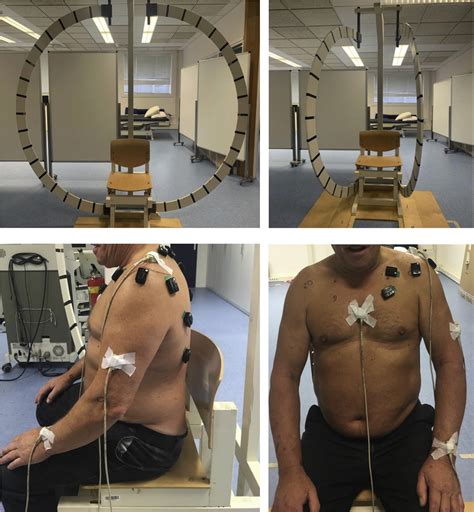 Shoulder Kinematics And Muscle Activity Following Latissimus Dorsi