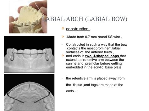 Removable Orthodontic Appliances