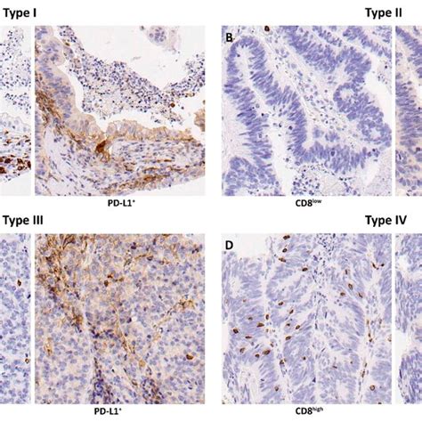 Immunohistochemical Staining Of Cd8⁺ Tils A And Cd68 B And Pd L1