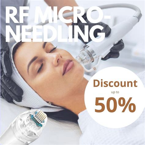 fractional rf micro needling   body vibes