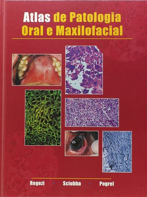 Atlas De Patologia Oral E Maxilofacial Livraria Internacional Sbs