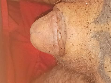 He Burns His Head With A Lighter Turkish Gay Bdsm Porn Xhamster