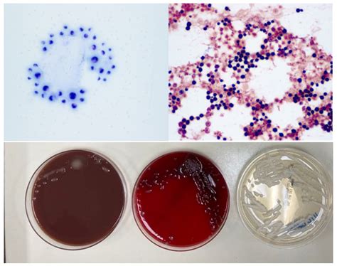 Cryptococcus Neoformans Gram Stain