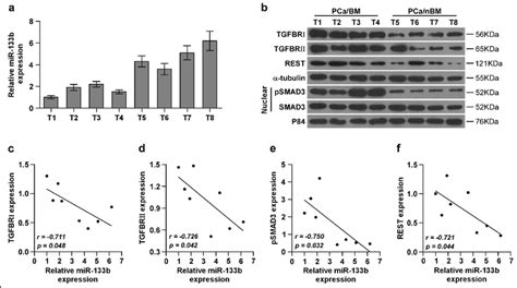 Clinical Relevance Of MiR 133b With TGFBRI TGFBRII And REST