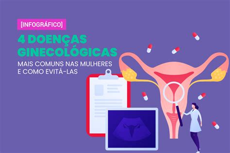 Infogr Fico Doen As Ginecol Gicas Mais Comuns Nas Mulheres E Como