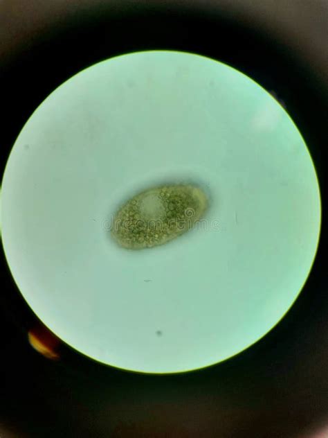 Plants Under The Microscope Stock Photo Image Of Yellow Organ 264681714