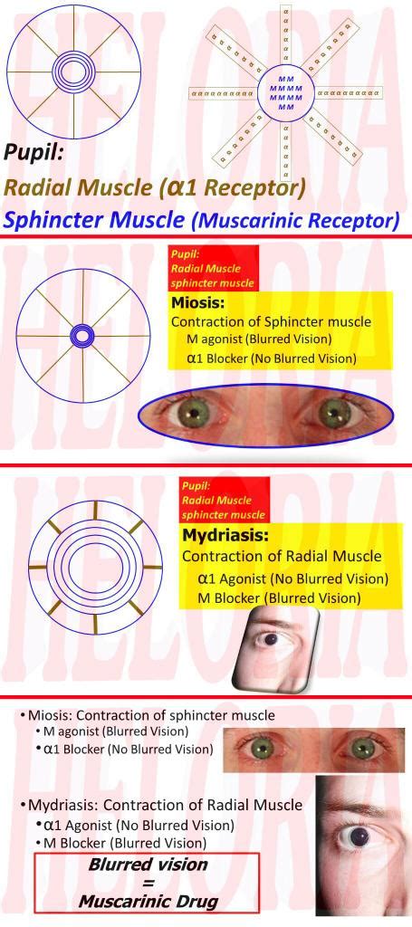 Mydriasis What Is It Pronunciation Causes Glaucoma Risk 60 Off