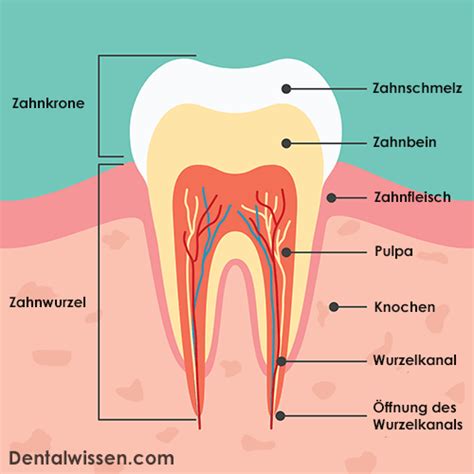 Pulpitis Proces And Behandeling Van De Ontstoken Tandzenuw Tand Info