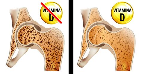 Se Ales De Que Tu Cuerpo Necesita Desesperadamente M S Vitamina D