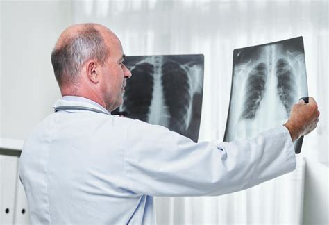 Lo Que Debes Saber Sobre Los Rayos X Resobert Medicina And Radiología