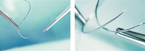 Рассасывающиеся нити: Рассасывающиеся нити – купить хирургические ...