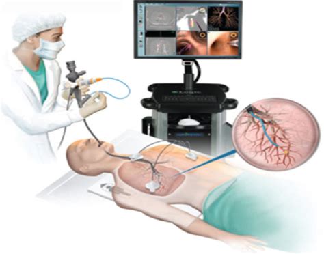 bronchoscopy  fiberoptic ebus rigid side effects