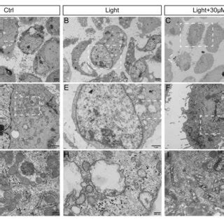 Ultrastructure Of Rpe Cells To Show Blue Light Damage And Protective