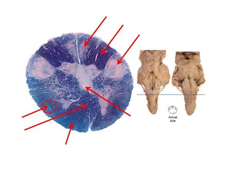caudal medulla level  pyramidal decussation diagram quizlet