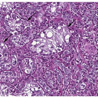 PDF A Case Of SRY Positive XY True Hermaphroditism XY Sex Reversal In A Cat