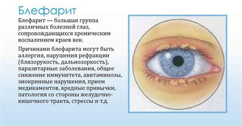 Фурацилиновая мазь – инструкция по применению, цена, от чего помогает ...