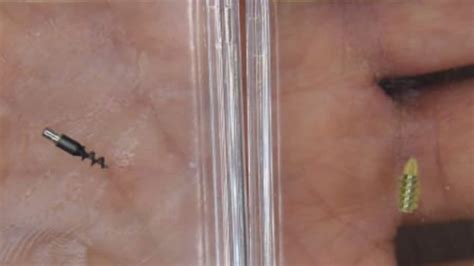 These Tiny Robots Could Travel Inside Human Skull and Treat Brain ...