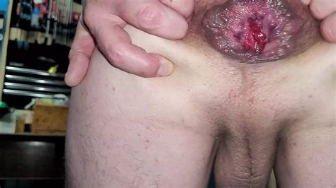 Shaved Gapped Anal Play Gay Amateur Amateur Porn Feat Willy1981 XHamster