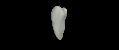 Stl File Endo Tooth 🦷 ・model To Download And 3d Print・cults