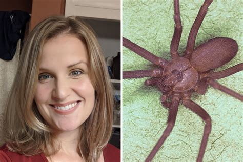Brown Recluse Spider Bite Victims Speak Out: 'Pain Like I've Never Felt