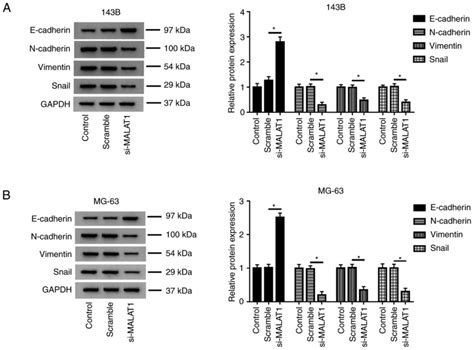 Long Noncoding Rna Malat Promotes Cell Proliferation Migration And