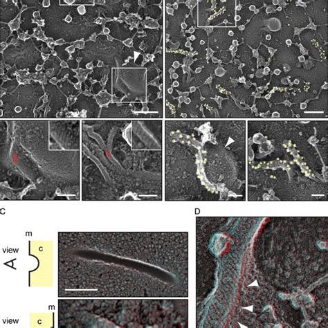 Purified Eisosome Proteins From Yeast Structurally Resemble Recombinant