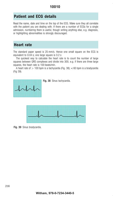 how to calculate hr on ecg 9