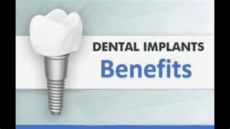 Benefits Of Dental Implants Youtube