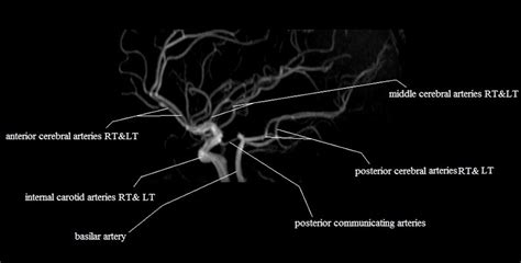 Radiology Anatomy Images : MRA Brain anatomy