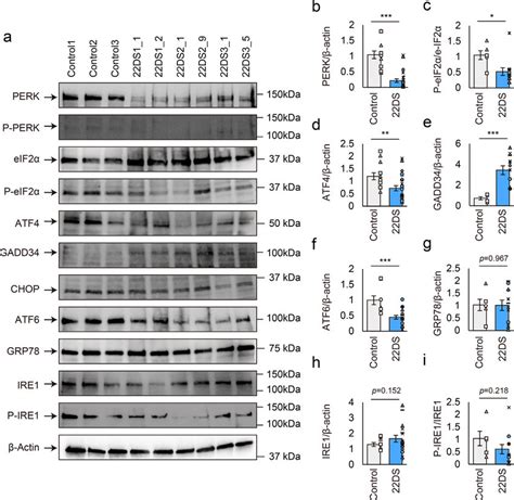 Downregulation Of PERK Expression And Activity In 22q11 2DS