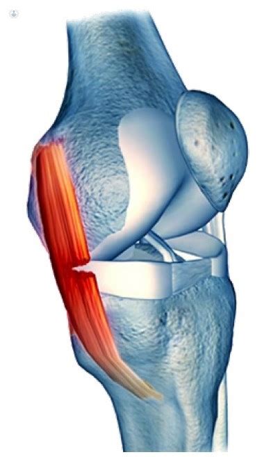 Ligamento Lateral Interno qué es síntomas y tratamiento Top Doctors