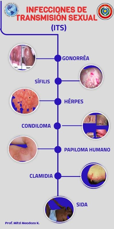 INFECCIONES DE TRANSMISIÓN SEXUAL