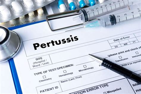 how to know if you have pertussis