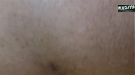 Anal Con Caca Search Xnxx