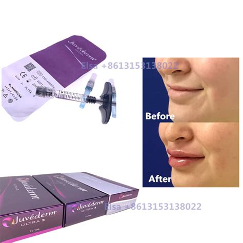 Injectable Dermal Filler Juvederm Syringe Ultra3 Ultra4 Voluma