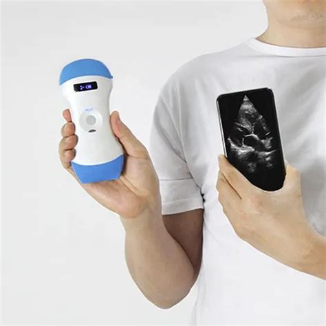 Dual Head Type Wireless Pocket Handheld Ultrasound Dw X1 Convex And