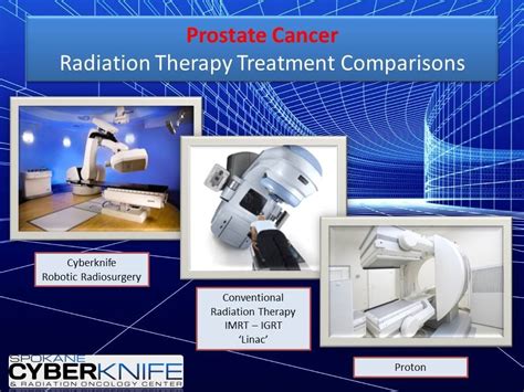 Prostate Cancer Treatment Options Clinical Outcome And Medicare Cost Comparison Youtube