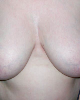 Oops I See Your Tit Porn Pictures Xxx Photos Sex Images Pictoa