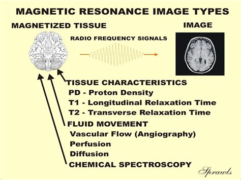 Magnetic Resonance Image Characteristics