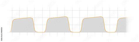 arterial pulse waveformcapnography waveform monitoring normal curve