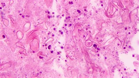 Pathology Outlines