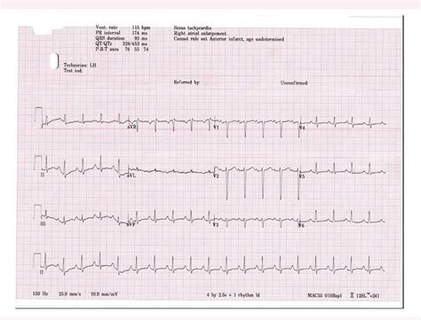 figure    rare case report  type  congenital disorders