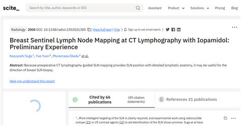 Breast Sentinel Lymph Node Mapping At Ct Lymphography With Iopamidol