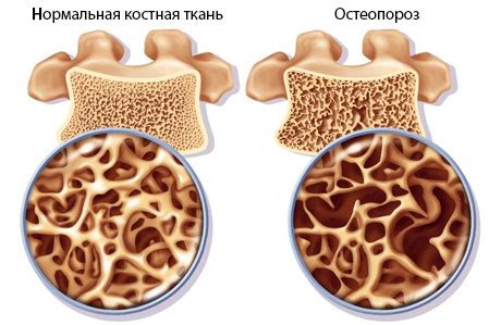 Элемвитал с органическим кальцием
