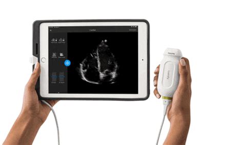 Handheld Portable Ultrasound Machine Philips Lumify